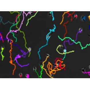 細(xì)胞趨化追蹤軌跡分析Chemotaxis Image Analysis